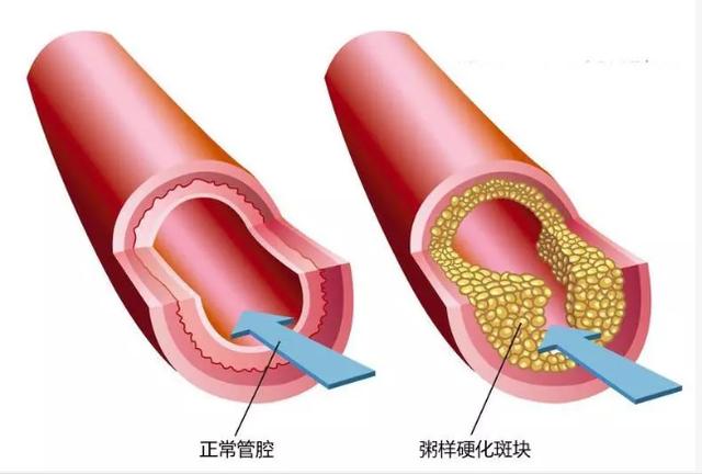 有时候腿疼可不简单，也许是外周血管出现了问题，进来看看吧