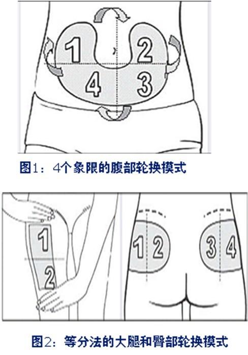 各种注射角度图片