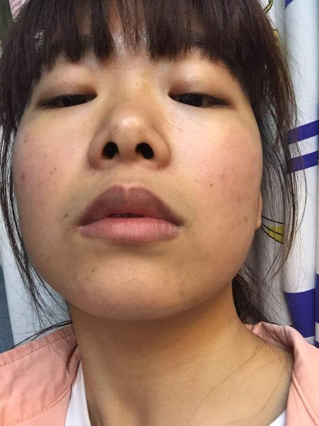 肺癌肝癌如果你嘴唇呈现下列5种颜色那要注意身体健康了