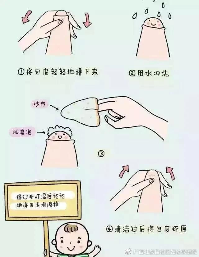 健康学堂丨男孩家长注意啦您孩子的包皮过长吗