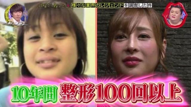 因长相酷似大猩猩花两千万整容，如今她成为日本第一女公关…