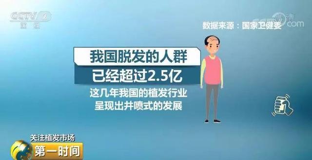 上海新生3D植发技术享誉国际，带动植发行业良性发展