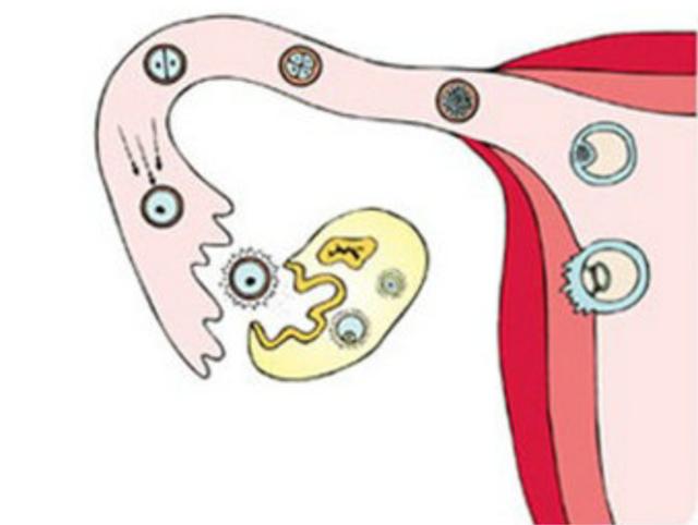 黄体破裂是什么情况这种常见妇科病很危险