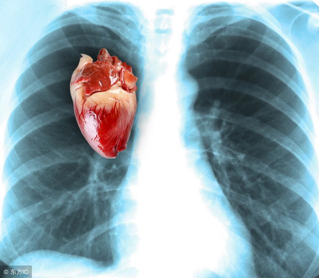 一般x光常常找不到肺部恶性肿瘤因为一公分以下x光根本看不到