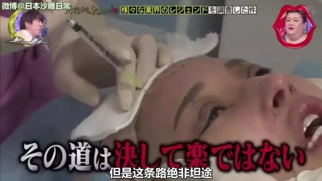 因长相酷似大猩猩花两千万整容，如今她成为日本第一女公关…