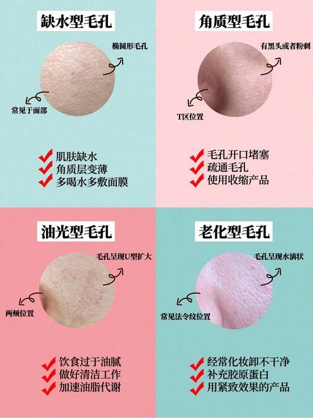 想要修复粗大毛孔,首先你必须要了解毛孔的类型和形成哦