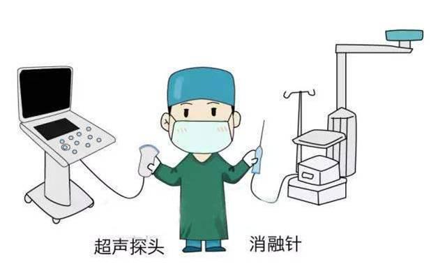 不开刀的微创消融术甲状腺结节消融是在超声引导和全程监视下进行的一