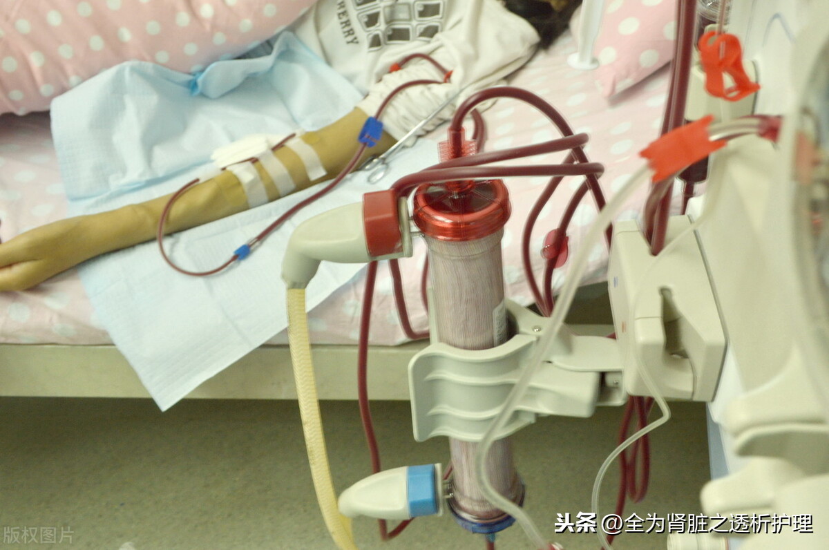 Hemodialysis device-dialyzer - iNEWS