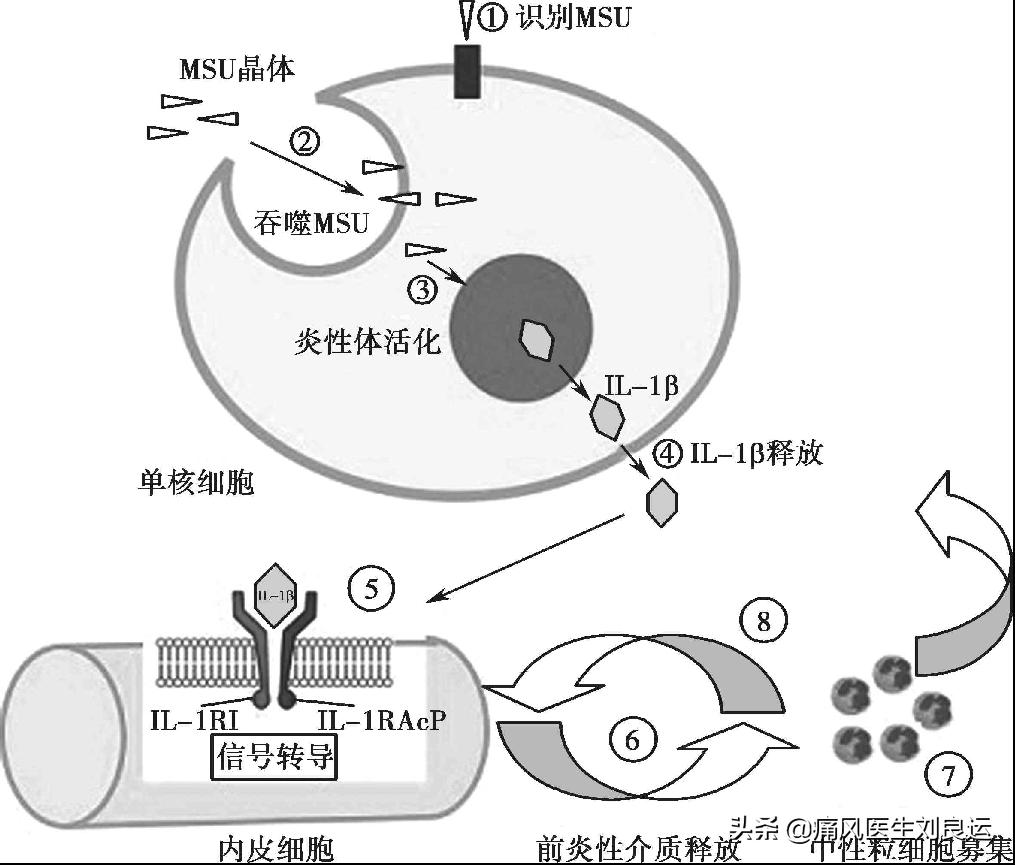 The effect of gout in Chinese pepper feet?Can pepper lower uric acid