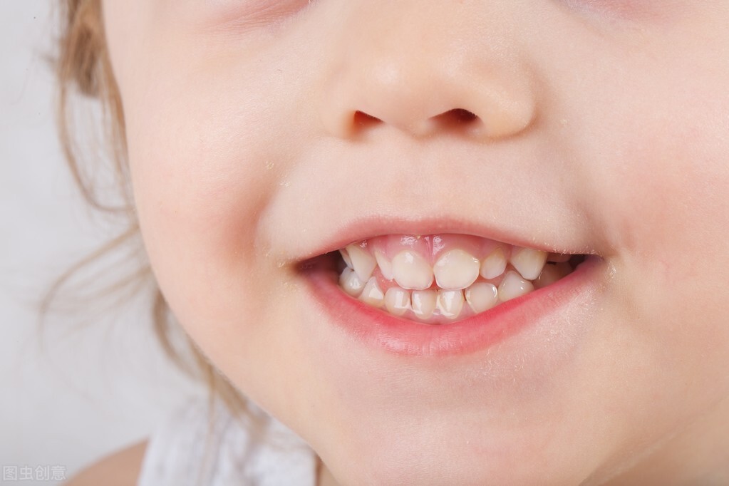 What is the reason why children's teeth turn black?Many parents ignore this iNEWS
