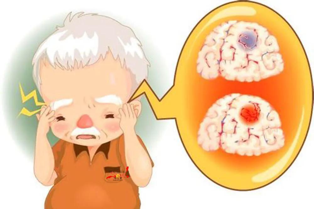 Can patients with high blood pressure take aspirin to stay away from