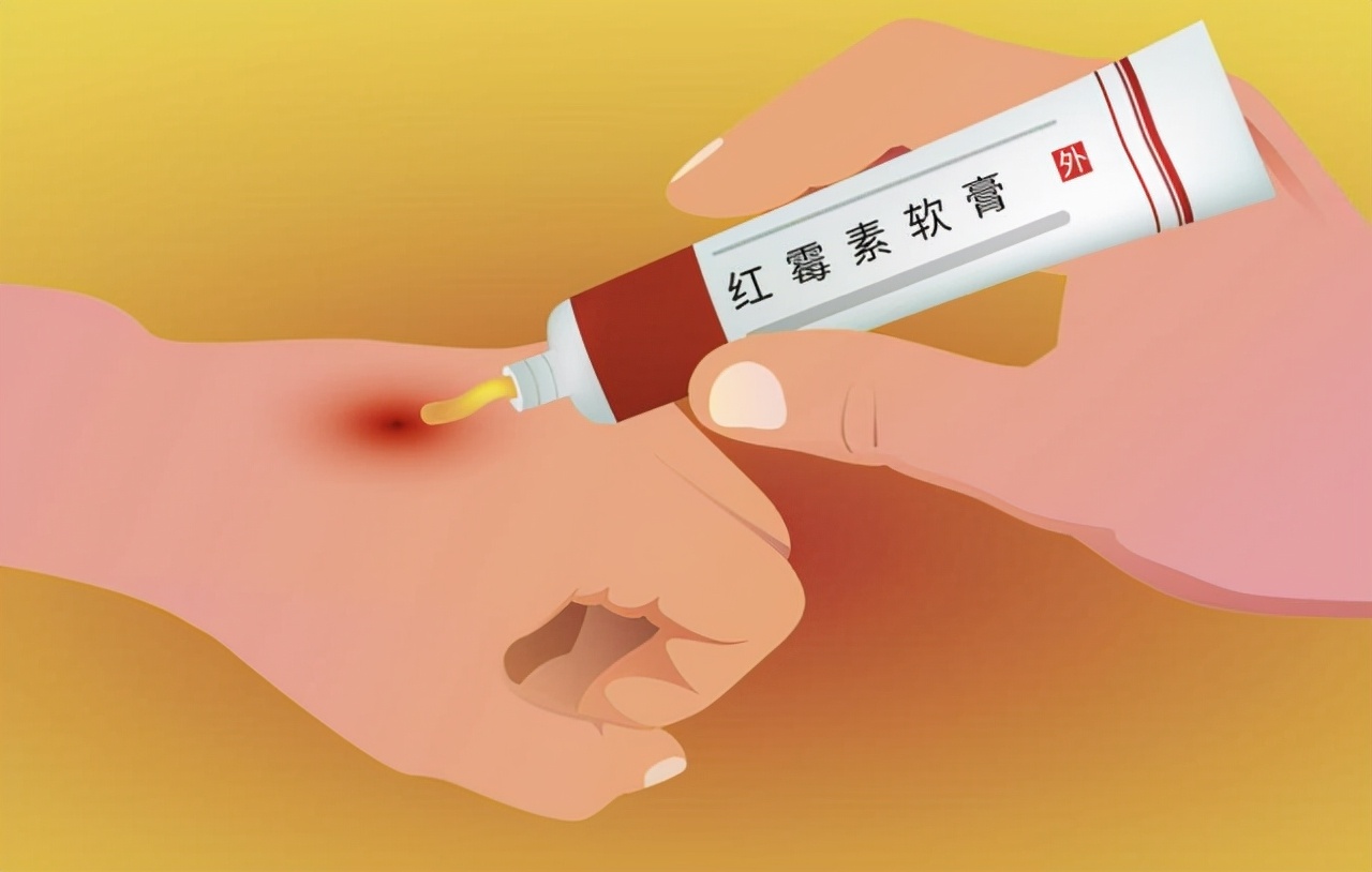 What are the benefits of applying erythromycin ointment to the eye area twice?Maybe you want to