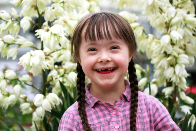 Why do people with Down syndrome look the same without the appearance ...