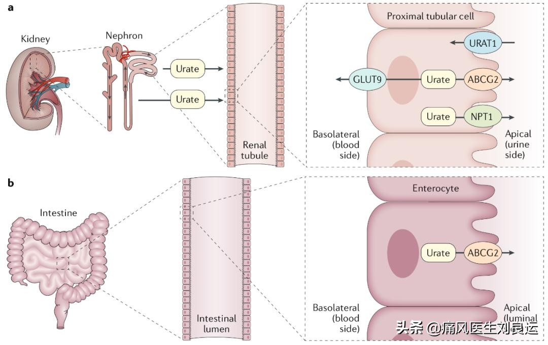 Baking soda can lower uric acid, why should I take febuxostat