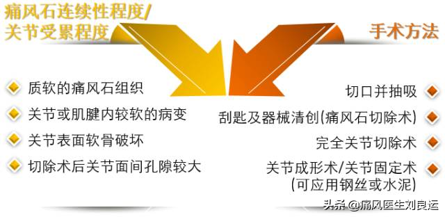 Tophi has seven characteristics and four negligences. There are three ...