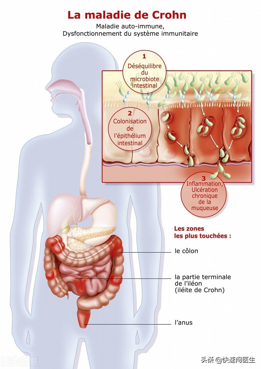Four methods can alleviate the symptoms of frequent damp and itching ...