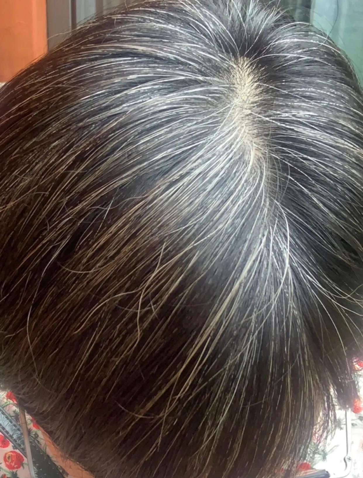 How does gray hair turn black?Share my personal experience iNEWS
