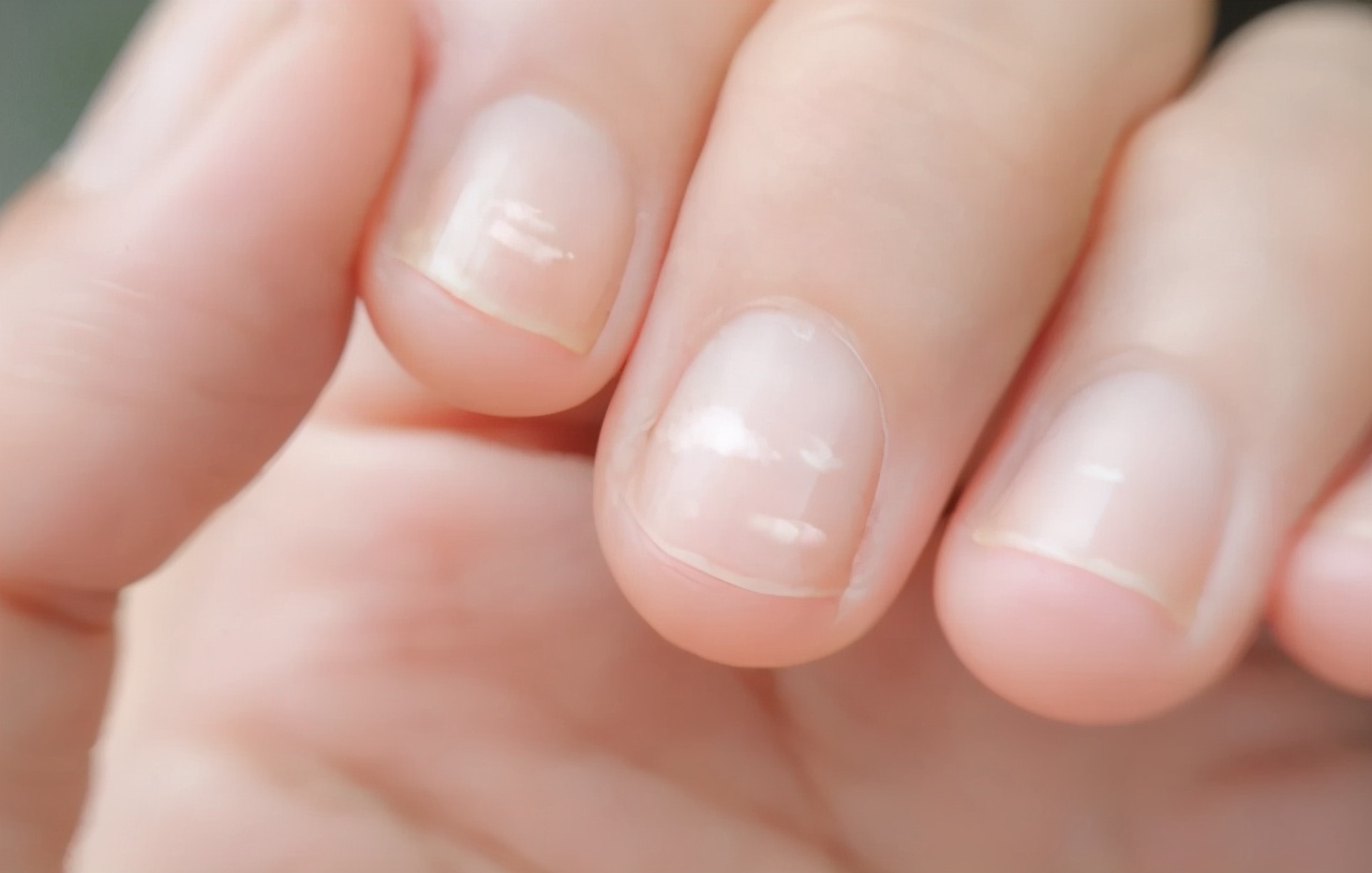 If the liver is not good, or the nails are known, the doctor reminds