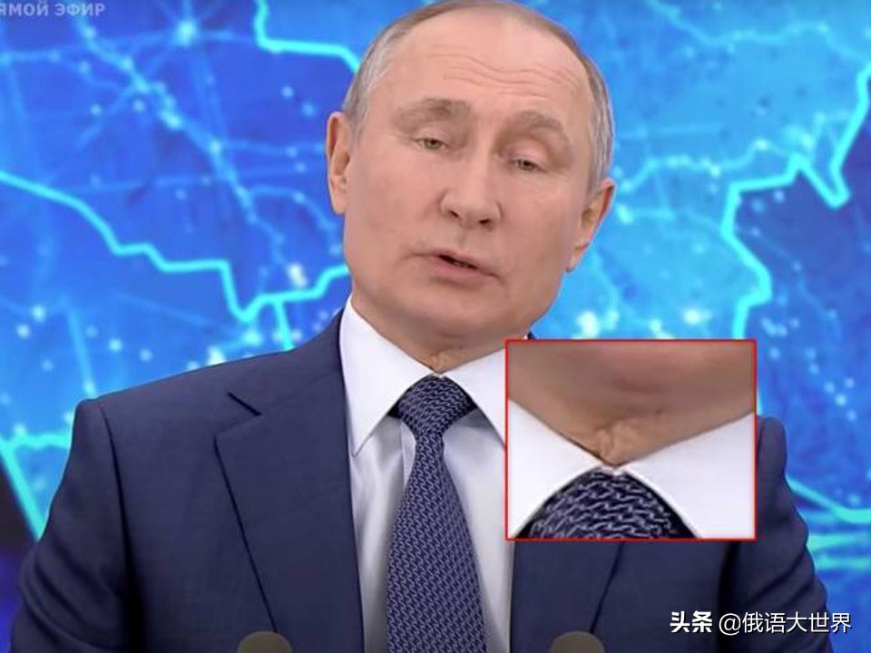 The Scar On Putins Neck Sparked Conjecture Has He Undergone A