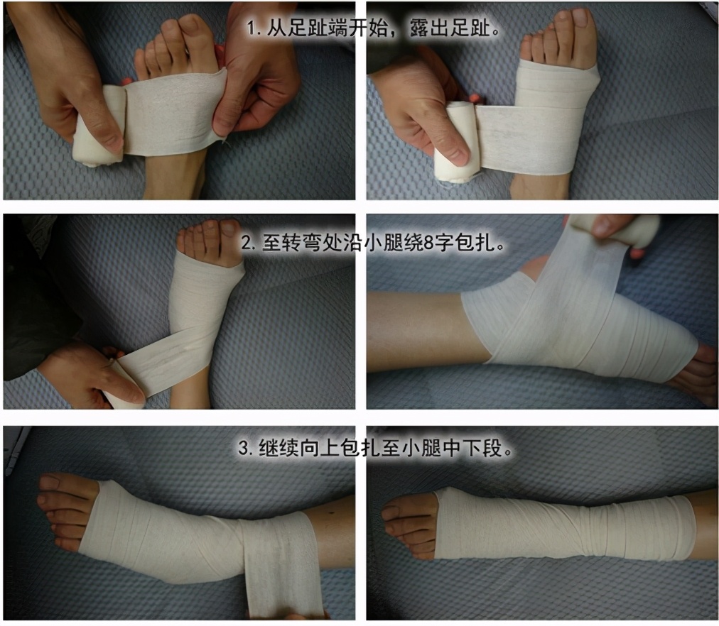 POLICE Principle To Deal With Ankle Sprain INEWS   5dc72f63714a4d98b772b698c6ef9683 