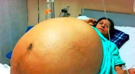 The pregnant belly is so big?A football team was born!More than a dozen ...