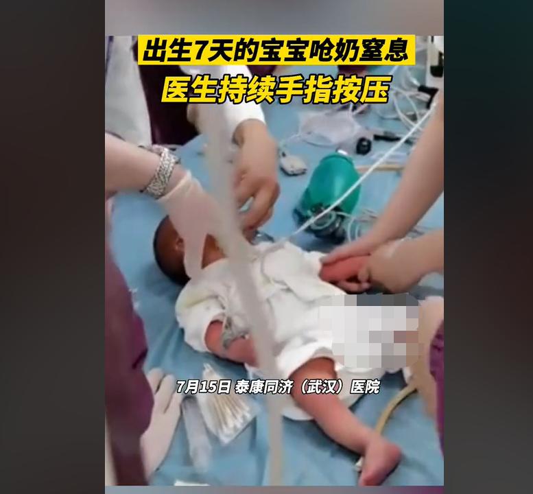 For 7 days, the baby choked with milk and lost his heartbeat to breathe