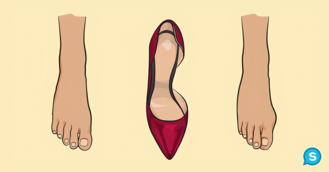 Foot pain without knowing the cause?6 kinds of "most hurting feet