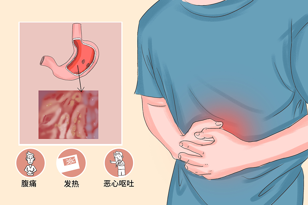 The Difference Between Acute Gastritis And Chronic Gastritis - INEWS