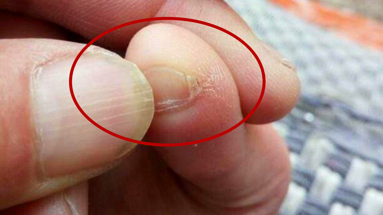 What is the origin of people who split their little toenails in two?Are you a purebred Han