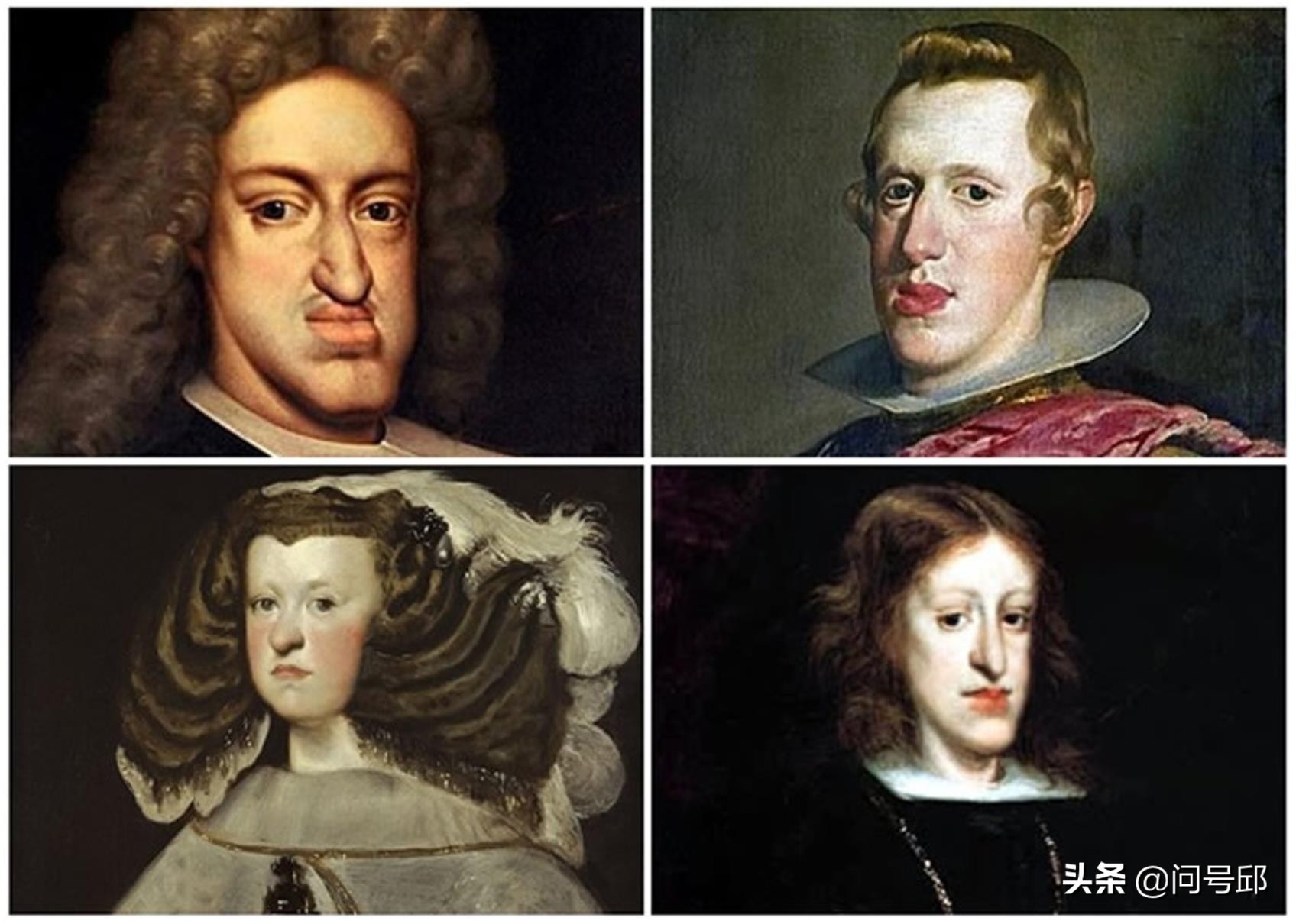 Centuries of inbreeding among European royals caused the deformity