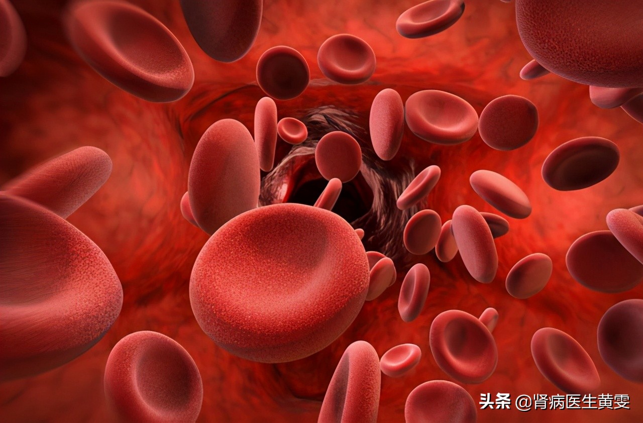 Why Does Kidney Failure Occur When Men Take Medicine With High Blood Fat How Does Traditional 
