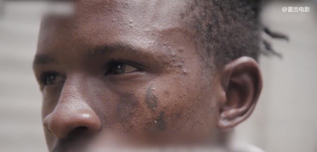 Zimbabwe, a small African country a country ruined by cough syrup