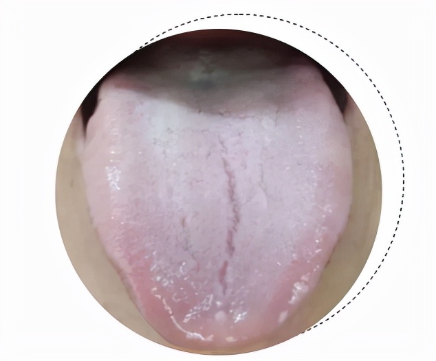 You must pay attention to these six tongue coatings iNEWS