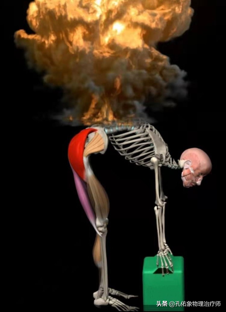 Why not only can I not bend down, but my back hurts when I bend? The