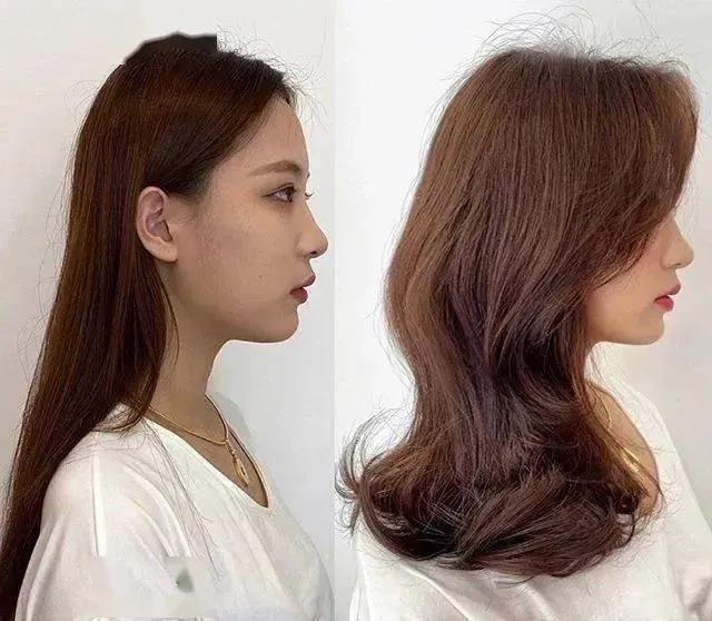 Wide face, protruding mouth, and nose collapsed, all of which were