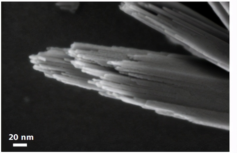 The magical micro world presented under the electron microscope - iNEWS