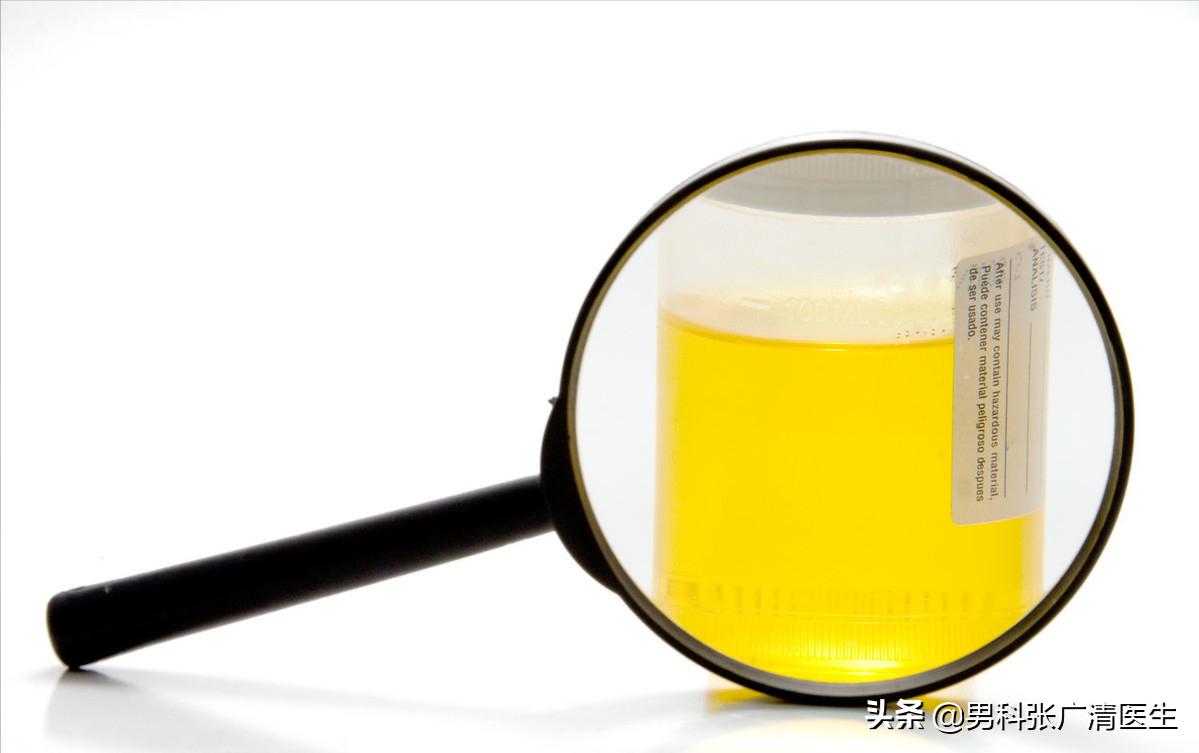 How to distinguish white turbidity, red turbidity, turbid urine, and turbidity? iNEWS
